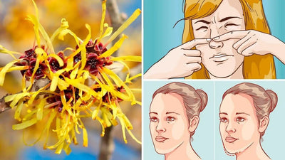 The Ancient Beauty Secret: Witch Hazel