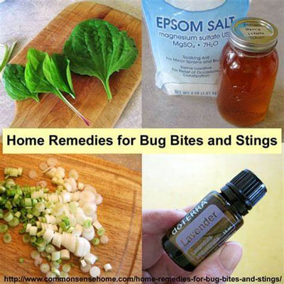 Effective Home Remedies for Bug Bites and Stings: Natural Relief That Works