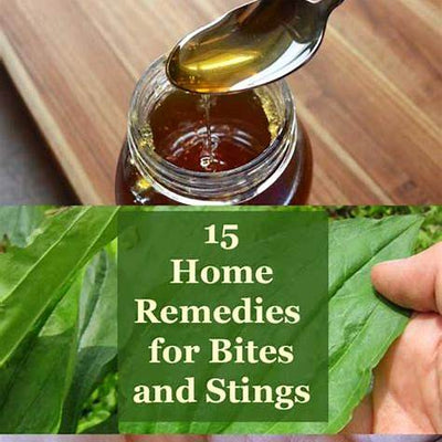 Natural Home Remedies for Bug Bites and Stings That Actually Work