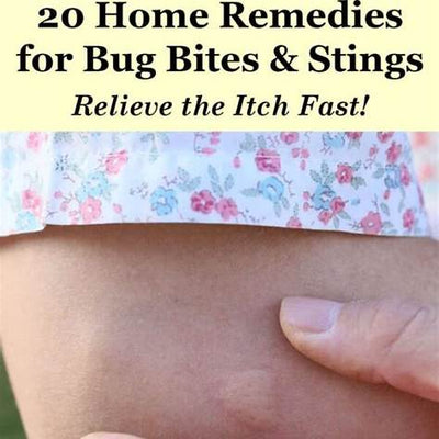 Effective Home Remedies for Bug Bites and Stings: Natural Relief That Works