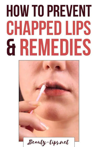 Protecting Your Lips Year-Round