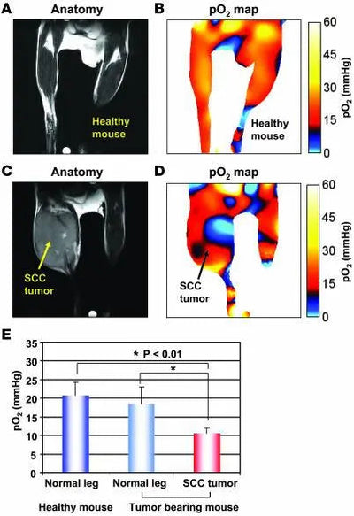 The Relationship Between Oxygen and Cancer