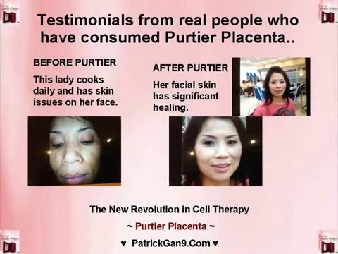 Purtier Placenta 6th edition oral Live Stem Cell Therapy in capsule - Benefits - Customer Review
