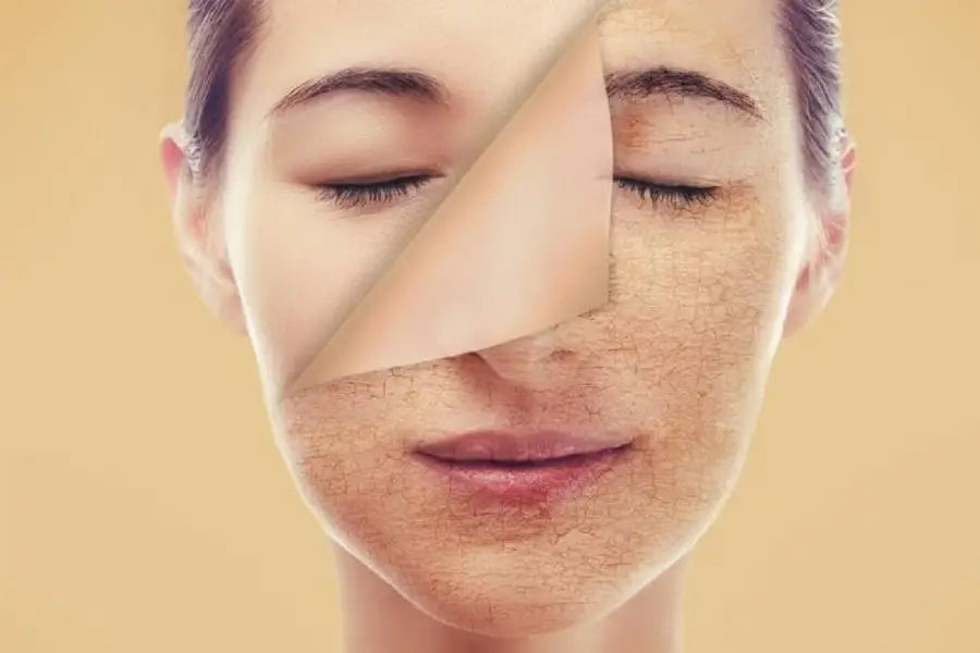 Skincare là gì? Quy trình và lợi ích của skin care như thế nào?